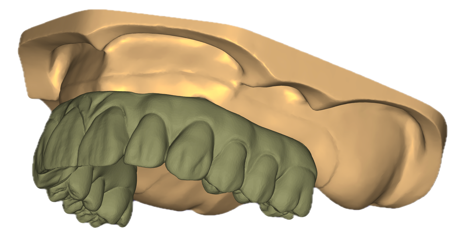 Dental CAD Design