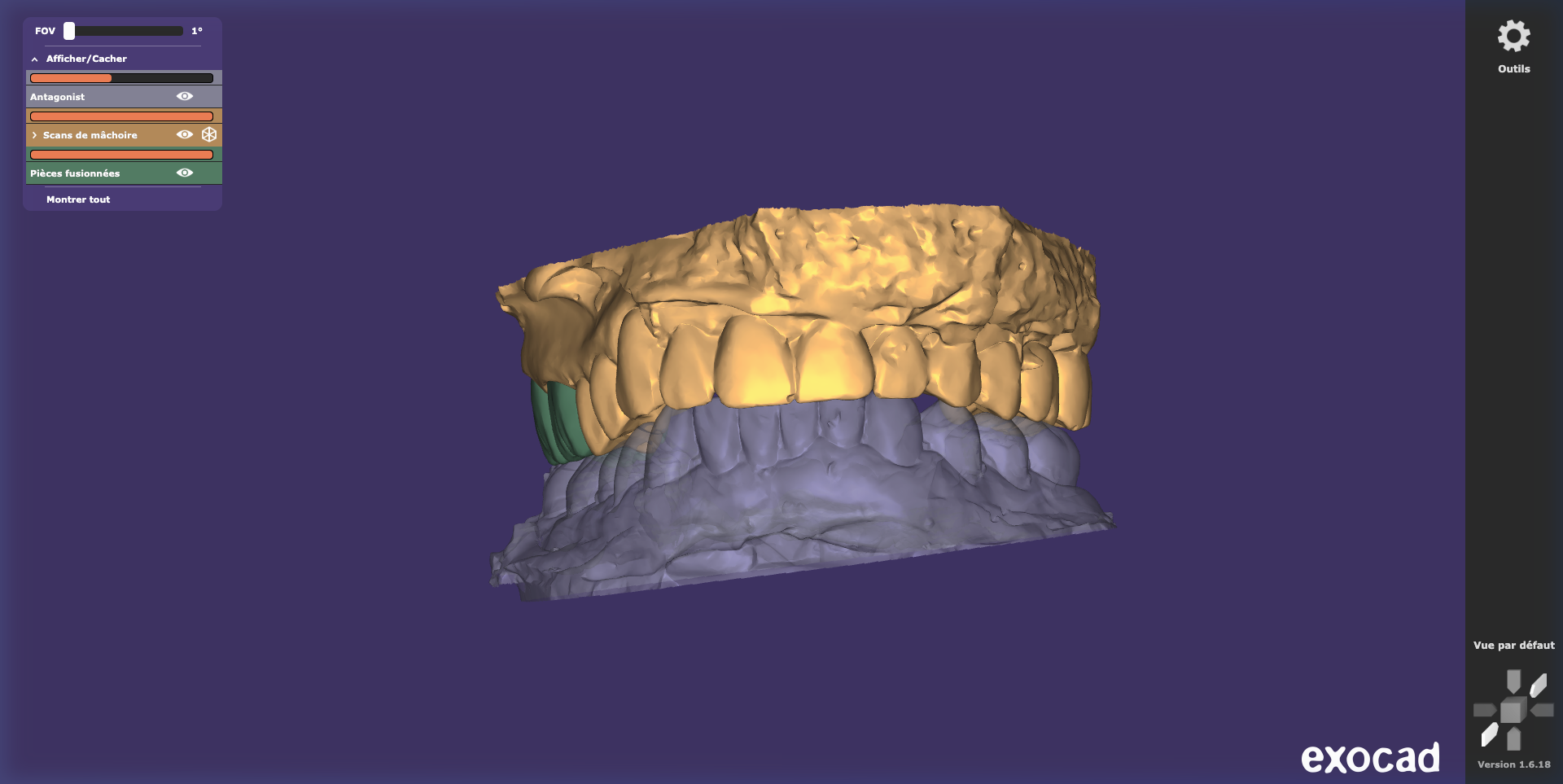 2 Unités Postérieures — Vue 3D