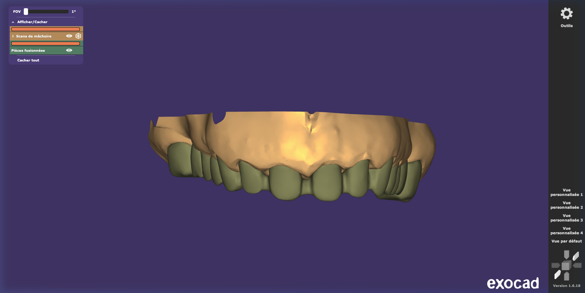 Chape Zircone — Vue 3D